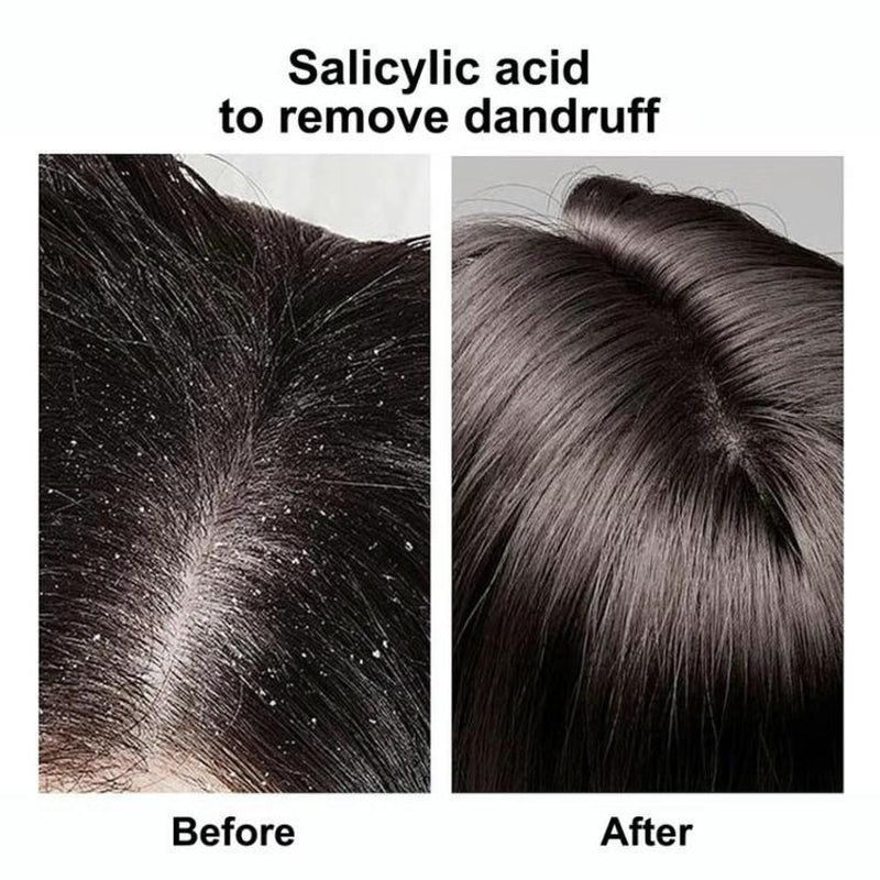 Sysni Organic Rosemary Hairthickening Shampoo, Promote Hairgrowth,Strengthening Shampoo, Preventhair Loss Cleansing Shampoo Rosemary Biotin