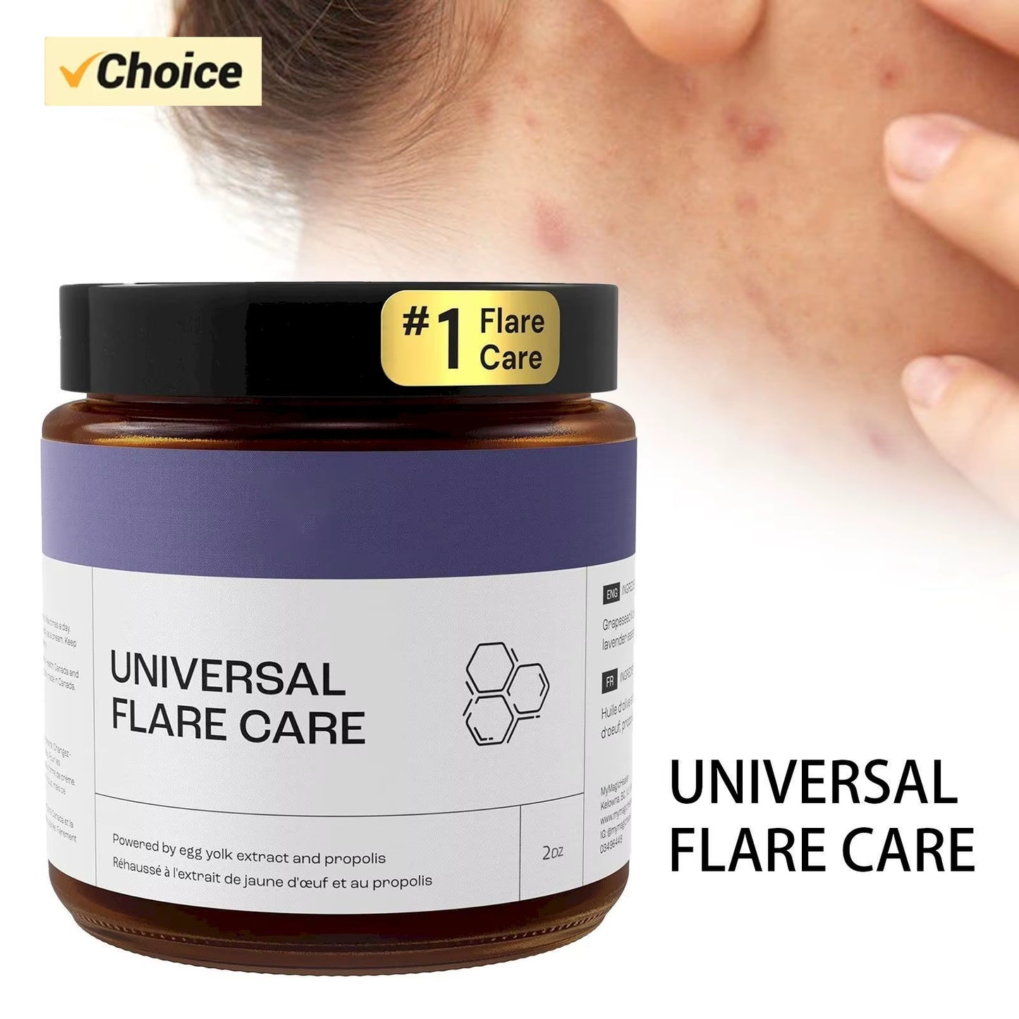 U Niversal | R Elieve Skin Problems | Hidradenitis Suppurativa Abscesses | Solution with and Egg Yolk Extracts 1.8 Oz