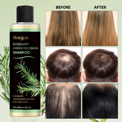 Organic Rosemary Oil Shampoo – Boosts Hair Growth, Thickness & Volume for Men & Women