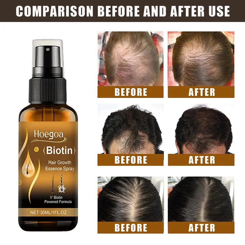 Biotin Fast Hair Growth Spray

Anti Hair Loss & Baldness Prevention Serum for Scalp & Beard – 30 ml