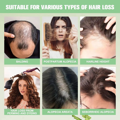 Organic Rosemary Oil Shampoo – Boosts Hair Growth, Thickness & Volume for Men & Women