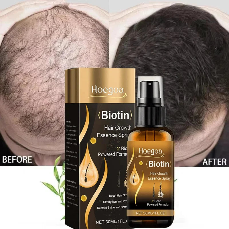 Biotin Fast Hair Growth Spray

Anti Hair Loss & Baldness Prevention Serum for Scalp & Beard – 30 ml