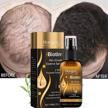 Biotin Fast Hair Growth Spray

Anti Hair Loss & Baldness Prevention Serum for Scalp & Beard – 30 ml