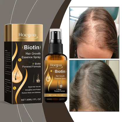 Biotin Fast Hair Growth Spray

Anti Hair Loss & Baldness Prevention Serum for Scalp & Beard – 30 ml